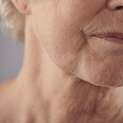 Facial con Dermaplaning